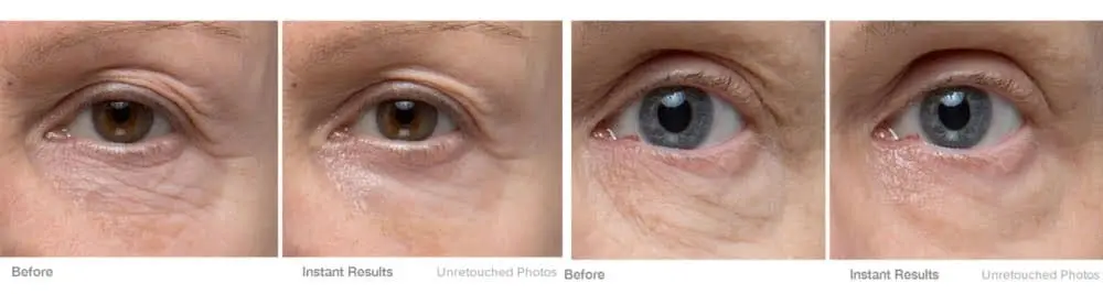 Murad facial before and after results at Queen B, Croydon